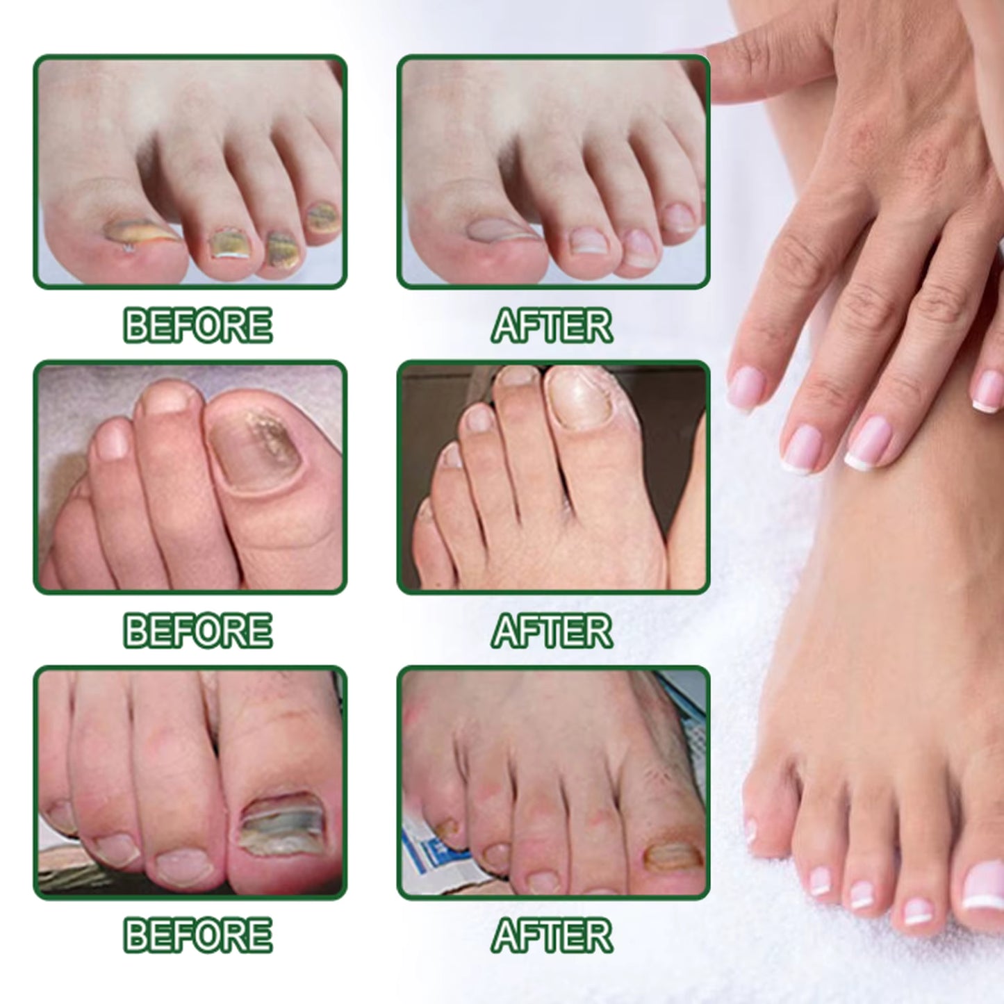 🌿 Sérum Réparateur pour Ongles EELHOE – Soin Nourrissant 50 ml