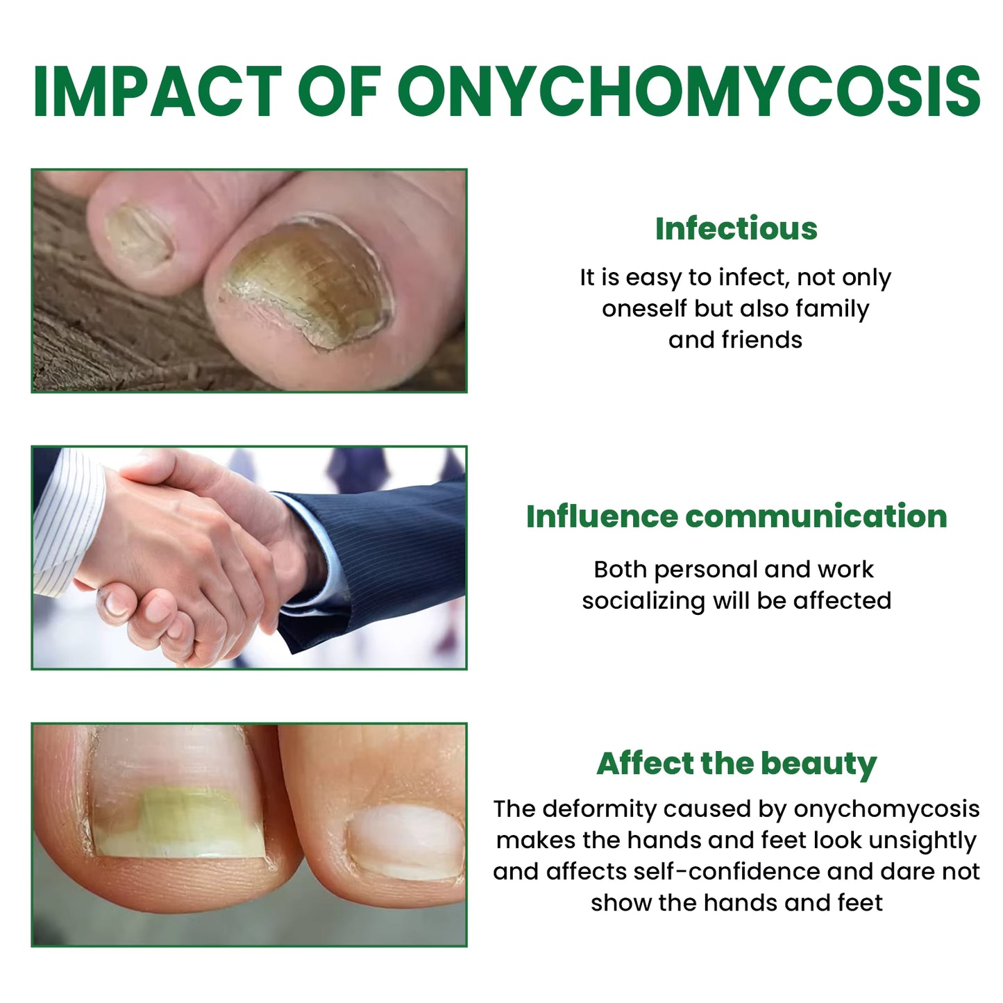 🌿 Sérum Réparateur pour Ongles EELHOE – Soin Nourrissant 50 ml