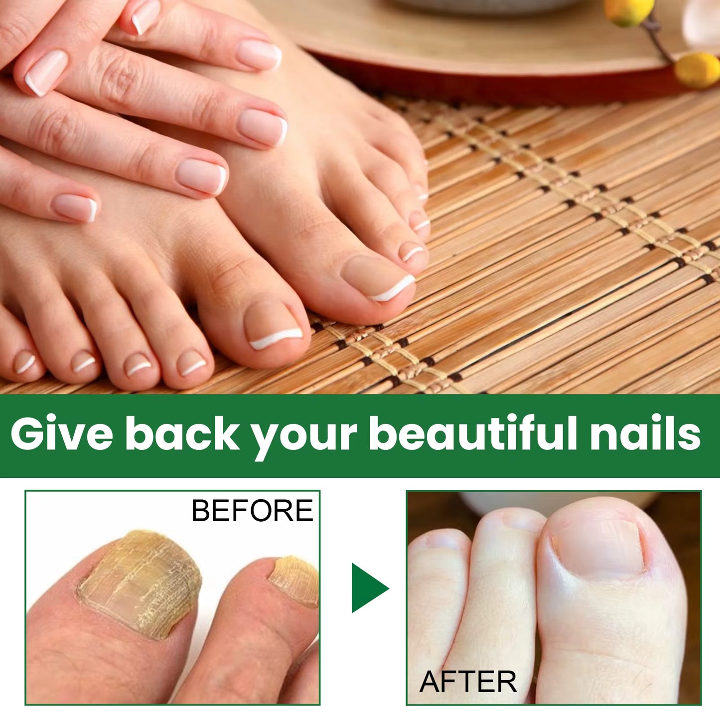 🌿 Sérum Réparateur pour Ongles EELHOE – Soin Nourrissant 50 ml